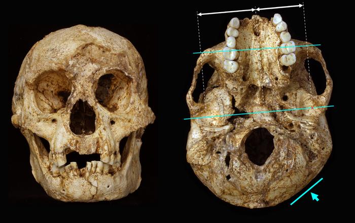 Skull of Hobbit human, Homo floresiensis Skull of Hobbit human, Homo floresiensis